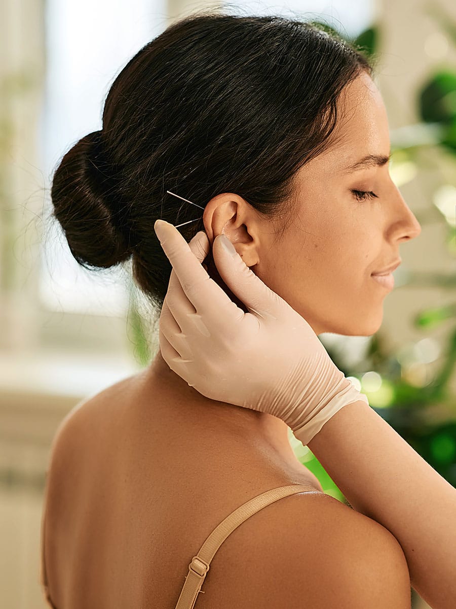 A practitioner wearing a beige glove carefully placing acupuncture needles into the ear of a woman with her hair in a bun.